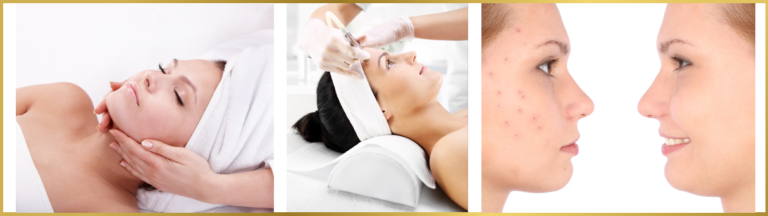 Header Microdermabrasion 768x216