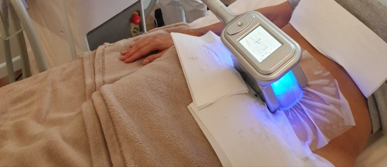 Kryolipolyse Bauchfett bei Marina Hirsch-Sanders