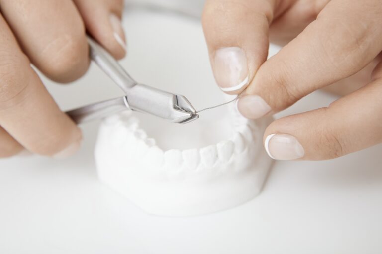 Retainer Stabilistor fuer gerade Zaehne KFO Sulbach Dr. Hillmann 768x512